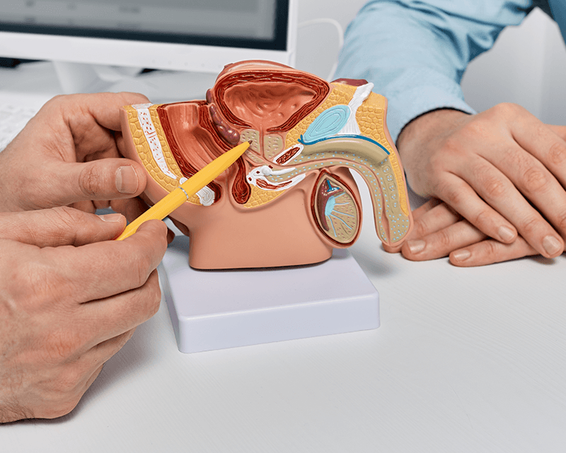 Esplorazione rettale della prostata: in cosa consiste e perché è importante