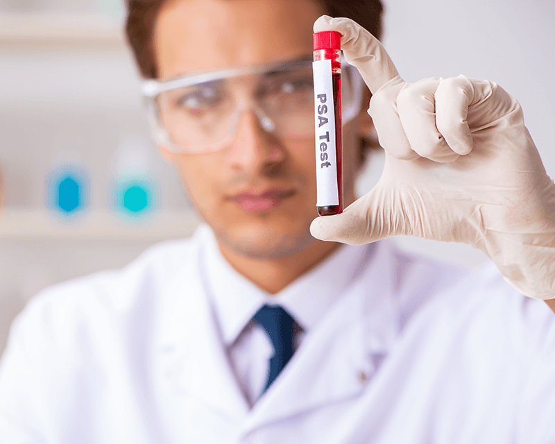 PSA o Antigene Prostatico Specifico